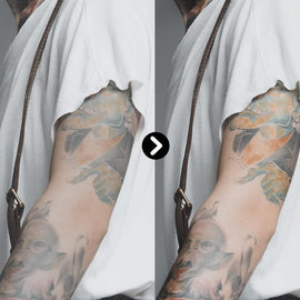 Tattoo-aufhellender Nachsorgebalsam